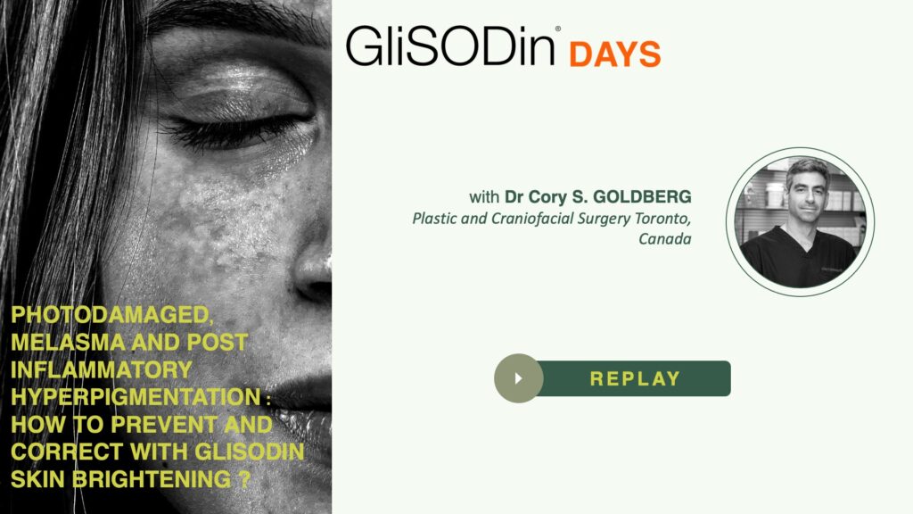 GliSODinDAYS-webinar-replay