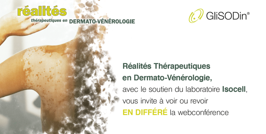 vitiligo-replay