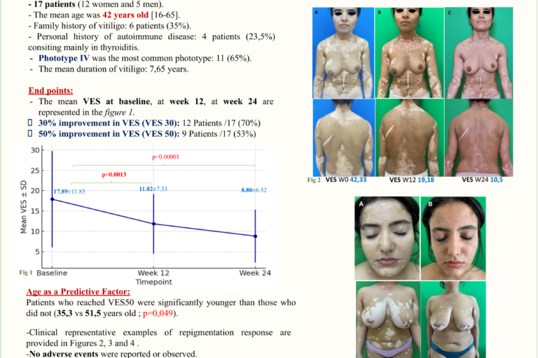 1-EADV PARIS-POSTER DENGUEZLI.pptx